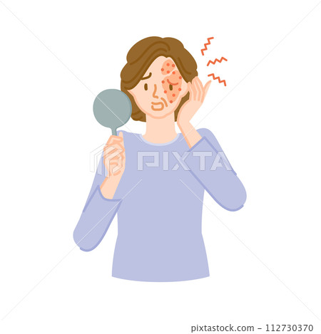 Shingles: A middle-aged woman with pain, itching, and swelling on her face Shingles: A middle-aged woman with pain, itching, and swelling on her face 112730370