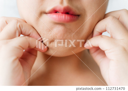 A woman with a puffy face and double chin. 112731470