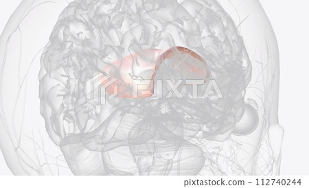 he corpus callosum , also callosal commissure, is a wide, thick nerve tract, consisting of a flat bundle of commissural fibers 112740244