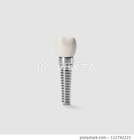 White tooth implant implant cut, healthy tooth or dental surgery. 112742225
