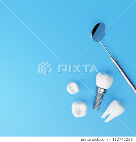 White tooth implant implant cut, healthy tooth or dental surgery. White tooth implant implant cut, healthy tooth or dental surgery. 112742228