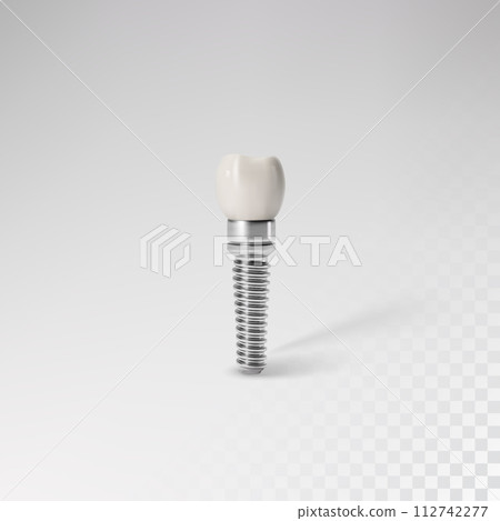 White tooth implant implant cut, healthy tooth or dental surgery. 112742277