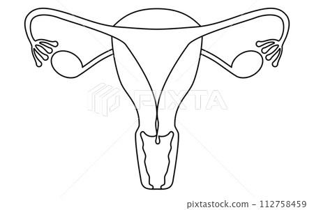 子宮頸息肉插圖、子宮和卵巢解剖圖 112758459