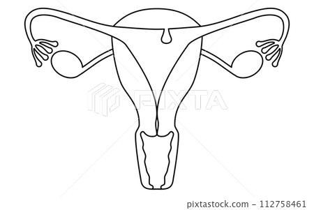 子宮內膜息肉插圖、子宮和卵巢解剖圖 112758461