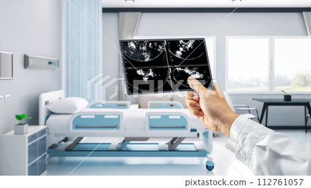 Doctor or sonographer with x-ray film 112761057