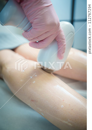 Closeup of a laser treatment on smooth legs with cooling gel dots, performed by a technician in pink gloves in a salon, highlighting hygiene and a serene clinical ambiance. 112767294