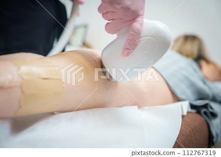 Closeup of a laser hair removal treatment on a client's leg in a beauty salon, with a technician using a handpiece on skin prepped with gel for safety and efficacy. 112767319