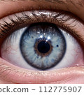 Blue eyes [close-up] 112775907