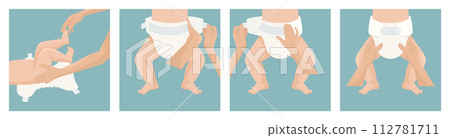 Flat Vector Illustration of a Baby Diaper. Side and Top View. Infant Underwear, Stages of Changing Diaper Panties. Ultimate Guide, Step by Step Diapering Tutorial. Tips for Diapering Flat Vector Illustration of a Baby Diaper. Side and Top View. Infant Underwear, Stages of Changing Diaper Panties. Ultimate Guide, Step by Step Diapering Tutorial. Tips for Diapering 112781711