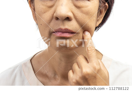 Flabby and wrinkled skin on senior woman face. Flabby and wrinkled skin on senior woman face. 112788122