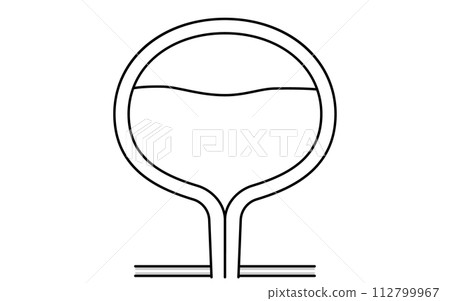 膀胱過動症的醫學插圖，這是一種正常膀胱儲存尿液的情況 112799967