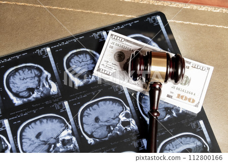 A composite of legal and medical concepts featuring brain MRI images, a gavel, and US currency. A composite of legal and medical concepts featuring brain MRI images, a gavel, and US currency. 112800166