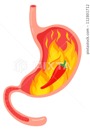 Hot food stomach problem. Gastric pain icon 112801712