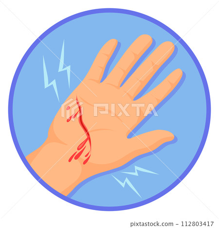 Bleeding palm with cut. Painful wound medical icon 112803417