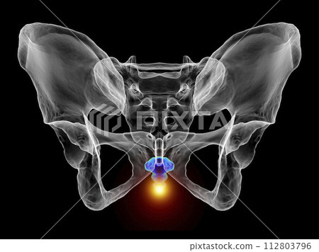 A 3D medical illustration highlighting the coccyx bone marked in red, depicting coccyx pain 112803796