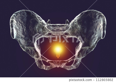 A 3D medical illustration highlighting the coccyx bone marked in red, depicting coccyx pain 112803802