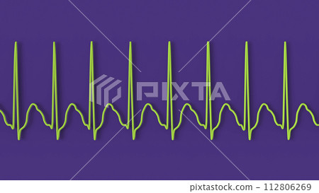 ECG in atrial flutter, 3D illustration ECG in atrial flutter, 3D illustration 112806269