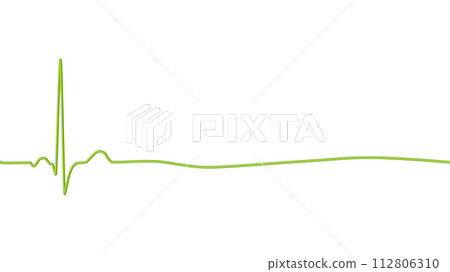 ECG in asystole, 3D illustration ECG in asystole, 3D illustration 112806310