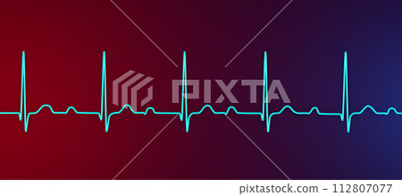 An ECG displaying 1st degree AV block, 3D illustration 112807077