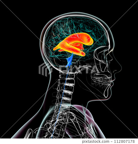 Enlarged lateral and third ventricles of the brain, 3D illustration 112807178