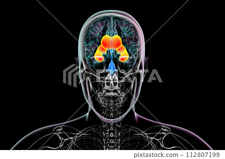 Enlarged lateral ventricles of the brain, 3D illustration Enlarged lateral ventricles of the brain, 3D illustration 112807199