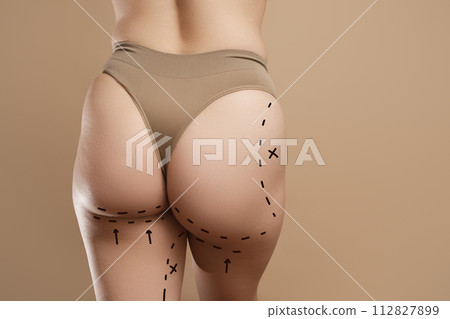 Female body with the drawing arrows. Buttocks, hip 112827899