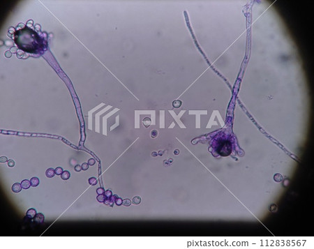 Aspergillus spores 112838567