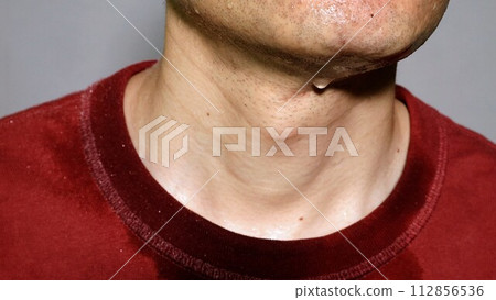 person sweating profusely person sweating profusely 112856536