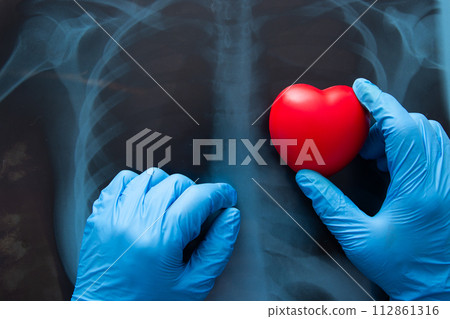 Red heart on x ray chest. Red heart on x ray chest. 112861316