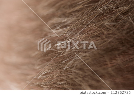 Macro shot of hair loss problem of blonde man hair closeup Macro shot of hair loss problem of blonde man hair closeup 112862725
