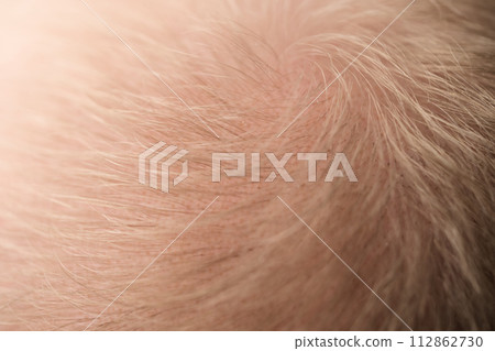 Macro shot of hair loss problem of blonde man hair closeup 112862730