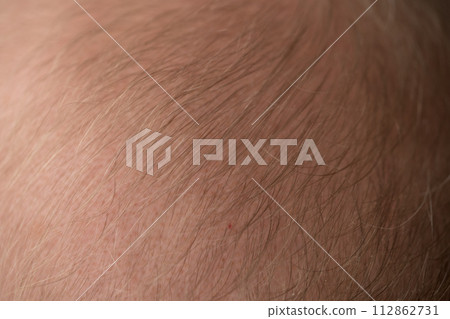 Macro shot of hair loss problem of blonde man hair closeup Macro shot of hair loss problem of blonde man hair closeup 112862731