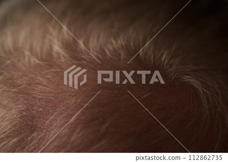 Macro shot of hair loss problem of blonde man hair closeup 112862735