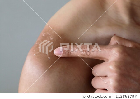 Person pointing at tanned skin Person pointing at tanned skin 112862797