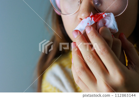 一名婦女用紙巾止住鼻血 一名婦女用紙巾止住鼻血 112863144