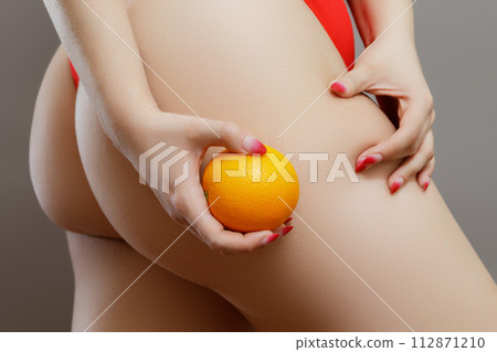 Stretch marks on female legs. A woman's hand holds Stretch marks on female legs. A woman's hand holds 112871210