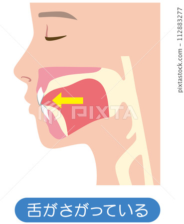 lowered tongue position 112883277