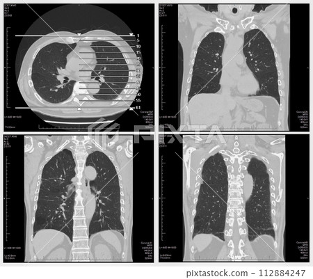 CT examination CT examination 112884247