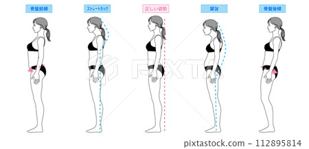 姿勢改善 姿勢矯正 駝背 直頸 骨盆後傾 骨盆前傾女性插圖 全身側向 112895814