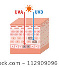 An illustration of ultraviolet rays and the structure of the skin to explain the mechanism of sunburn. Three-dimensional vector illustration. 112909096
