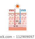 An illustration of ultraviolet rays and the structure of the skin to explain the mechanism of sunburn. Flat vector illustration. 112909097