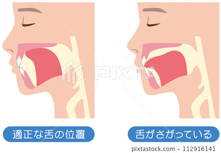 Correct and lowered tongue position - Mewing 112916141