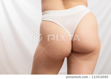 Real Natural human skin . No retouch . body 112918085