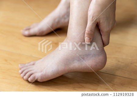 sprained ankle 112919328