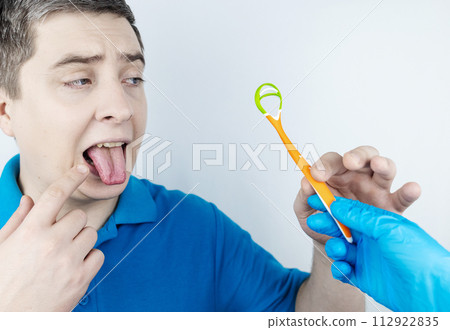 Tongue scraper. Man shows yellow plaque and then performs oral hygiene. Cleaning the tongue with special tool. Doctor recommendations and dentist advice. Before and after. Removing unpleasant odor 112922835