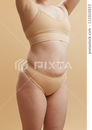 Body imperfections. Real human skin without 112928933