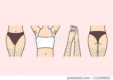 Hairy female legs and thighs in need of depilation or epilation using wax tape and sugaring 112940652