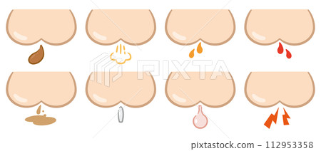 Illustration set of buttocks and various symptoms Illustration set of buttocks and various symptoms 112953358
