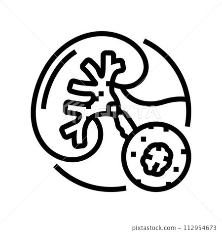 urolithiasis urology line icon vector illustration 112954673