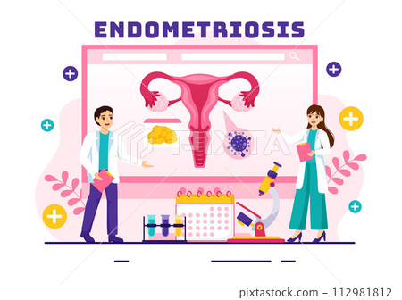 Endometriosis Vector Illustration with Condition the Endometrium Grows Outside the Uterine Wall in Women for Treatment in Flat Cartoon Background 112981812